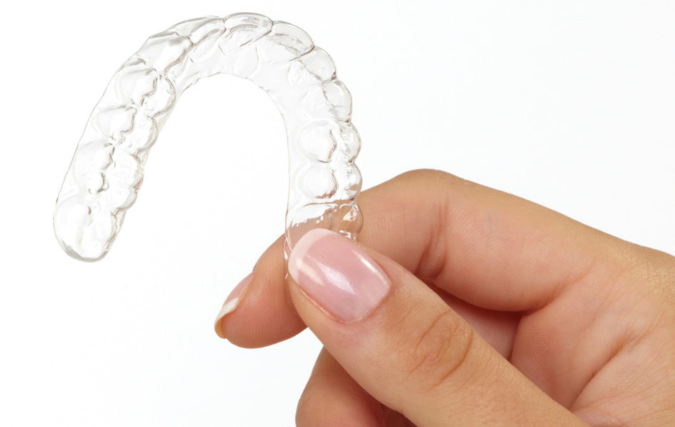 Clear Aligner
